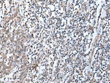 DEFB104A / BD-4 Antibody - Immunohistochemistry of paraffin-embedded Human tonsil tissue  using DEFB104A Polyclonal Antibody at dilution of 1:50(×200)