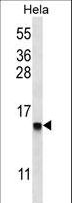 DEFB112 Antibody - DEFB112 Antibody western blot of HeLa cell line lysates (35 ug/lane). The DEFB112 antibody detected the DEFB112 protein (arrow).