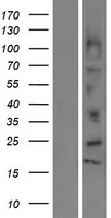 DEFB112 Protein - Western validation with an anti-DDK antibody * L: Control HEK293 lysate R: Over-expression lysate