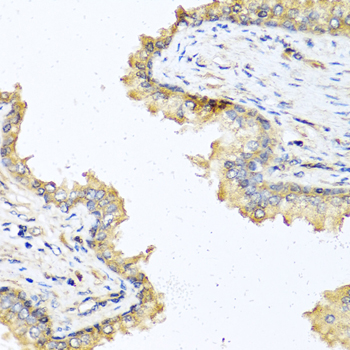 DEFB121 Antibody - Immunohistochemistry of paraffin-embedded human prostate.