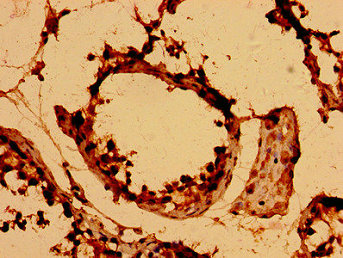 DEFB126 Antibody - Immunohistochemistry image of paraffin-embedded human testis tissue at a dilution of 1:100