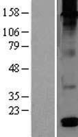 DEFB126 Protein - Western validation with an anti-DDK antibody * L: Control HEK293 lysate R: Over-expression lysate