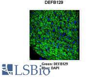 DEFB129 Antibody - DEFB129 antibody Immunohistochemistry of pig bronchus smooth muscle.  This image was taken for the unconjugated form of this product. Other forms have not been tested.