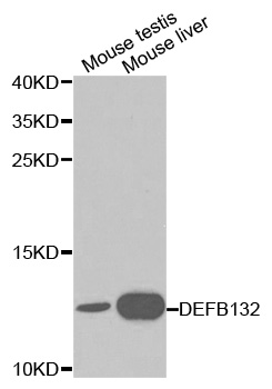 DEFB132 Antibody - Western blot analysis of extracts of various cell lines, using DEFB132 antibody at 1:1000 dilution. The secondary antibody used was an HRP Goat Anti-Rabbit IgG (H+L) at 1:10000 dilution. Lysates were loaded 25ug per lane and 3% nonfat dry milk in TBST was used for blocking.