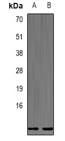 DEFB132 Antibody - Western blot analysis of Defensin beta 132 expression in mouse testis (A); mouse liver (B) whole cell lysates.