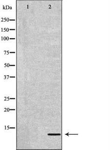 DEFB132 Antibody - Western blot analysis of mouse liver tissue lysate using DEFB132 antibody. The lane on the left is treated with the antigen-specific peptide.