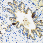 DEFB4A / BD-2 Antibody - Immunohistochemistry of paraffin-embedded rat lung using DEFB4A antibody at dilution of 1:100 (40x lens).
