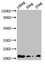 Defensin-like protein 2 Antibody - Western Blot Positive WB detected in Recombinant protein All lanes: AFP2 antibody at 3µg/ml Secondary Goat polyclonal to rabbit IgG at 1/50000 dilution predicted band size: 22 kDa observed band size: 22 kDa