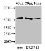DEGP12 Antibody - Western Blot Positive WB detected in: Arabidopsis thaliana (40µg, 20µg, 10µg) All lanes: DEGP12 antibody at 3.4µg/ml Secondary Goat polyclonal to rabbit IgG at 1/50000 dilution Predicted band size: 56 kDa Observed band size: 56 kDa