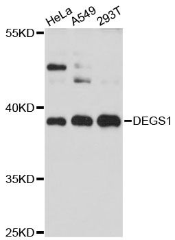DEGS1 Antibody - Western blot analysis of extracts of various cell lines, using DEGS1 antibody at 1:3000 dilution. The secondary antibody used was an HRP Goat Anti-Rabbit IgG (H+L) at 1:10000 dilution. Lysates were loaded 25ug per lane and 3% nonfat dry milk in TBST was used for blocking. An ECL Kit was used for detection and the exposure time was 10s.