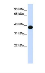 DEGS1 Antibody - Fetal muscle lysate. Antibody concentration: 1.0 ug/ml. Gel concentration: 12%.  This image was taken for the unconjugated form of this product. Other forms have not been tested.