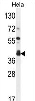 DEGS2 Antibody - DEGS2 Antibody western blot of HeLa cell line lysates (35 ug/lane). The DEGS2 antibody detected the DEGS2 protein (arrow).
