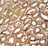 DEGS2 Antibody - DEGS2 antibody immunohistochemistry of formalin-fixed and paraffin-embedded human kidney tissue followed by peroxidase-conjugated secondary antibody and DAB staining.