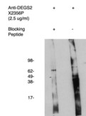 DEGS2 Antibody - Western blot of antigen immunoaffinity purified and DEGS2 antibody on human kidney cell lysate. Lysate used at 15 ug/lane. Antibody used at 1:400 dilution. Secondary antibody, mouse anti-rabbit HRP, used at 1:50k dilution. Visualized using Pierce West Femto substrate system. Exposure for 5 minutes 