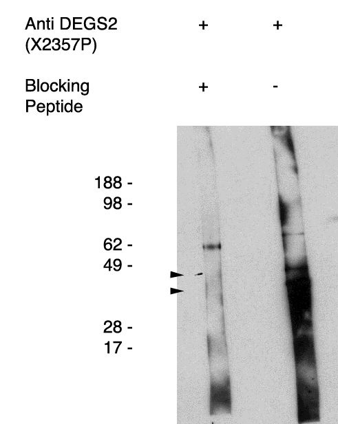 DEGS2 Antibody - Western blot of antigen immunoaffinity purified anti DEGS2 antibody on human kidney cell lysate. Lysate used at 15 ug/lane. Antibody used at 1:400 dilution. Secondary antibody, mouse anti-rabbit HRP, used at 1:50k dilution. Visualized using Pierce West Femto substrate system. Exposure for 5 minutes 