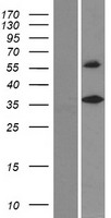 DEGS2 Protein - Western validation with an anti-DDK antibody * L: Control HEK293 lysate R: Over-expression lysate