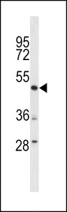 DEK Antibody - Western blot of lysates from U-251 MG, PC-3 cell line (from left to right), using DEK Antibody. Antibody was diluted at 1:1000 at each lane. A goat anti-rabbit IgG H&L (HRP) at 1:5000 dilution was used as the secondary antibody. Lysates at 35ug per lane.