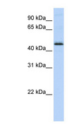 DEK Antibody - DEK antibody Western blot of MCF7 cell lysate. This image was taken for the unconjugated form of this product. Other forms have not been tested.