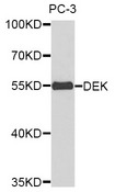 DEK Antibody - Western blot analysis of extracts of various cell lines.