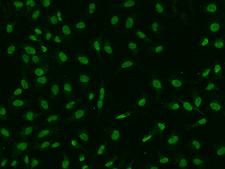 DEK Antibody - Immunofluorescence staining of DEK in Hela cells. Cells were fixed with 4% PFA, permeabilzed with 0.1% Triton X-100 in PBS, blocked with 10% serum, and incubated with rabbit anti-Human DEK polyclonal antibody (dilution ratio 1:100) at 4°C overnight. Then cells were stained with the Alexa Fluor 488-conjugated Goat Anti-rabbit IgG secondary antibody (green). Positive staining was localized to Nucleus.