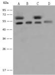 DEK Antibody - Anti-DEK rabbit polyclonal antibody at 1:500 dilution. Lane A: HeLa Whole Cell Lysate. Lane B: 293T Whole Cell Lysate. Lane C: Jurkat Whole Cell Lysate. Lane D: K562 Whole Cell Lysate. Lysates/proteins at 30 ug per lane. Secondary: Goat Anti-Rabbit IgG (H+L)/HRP at 1/10000 dilution. Developed using the ECL technique. Performed under reducing conditions. Predicted band size: 42 kDa. Observed band size: 50 kDa. (We are unsure as to the identity of these extra bands.)