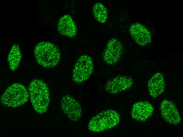 DEK Antibody - Immunofluorescence staining of DEK in Hela cells. Cells were fixed with 4% PFA, permeabilzed with 0.3% Triton X-100 in PBS, blocked with 10% serum, and incubated with rabbit anti-Human DEK polyclonal antibody (dilution ratio 1:5000) at 4°C overnight. Then cells were stained with the Alexa Fluor 488-conjugated Goat Anti-rabbit IgG secondary antibody (green). Positive staining was localized to nucleus.