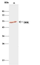 DEK Antibody - DEK was immunoprecipitated using: Lane A: 0.5 mg K562 Whole Cell Lysate. 1 uL anti-DEK rabbit polyclonal antibody and 15 ul of 50% Protein G agarose. Primary antibody: Anti-DEK rabbit polyclonal antibody, at 1:500 dilution. Secondary antibody: Clean-Blot IP Detection Reagent (HRP) at 1:500 dilution. Developed using the DAB staining technique. Performed under reducing conditions. Predicted band size: 42 kDa. Observed band size: 42 kDa.