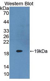 Delta-6 Desaturase / FADS2 Antibody - Western blot of Delta-6 Desaturase / FADS2 antibody using recombinant protein encoding amino acids 1-130.