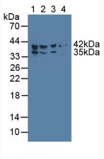 Delta-6 Desaturase / FADS2 Antibody - Western Blot; Sample: Lane1: Human HepG2 Cells; Lane2: Porcine Liver Tissue; Lane3: Porcine Large IntestineTissue; Lane4: Rat Pancreas Tissue.