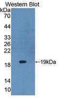 Delta-6 Desaturase / FADS2 Antibody - Western blot of Delta-6 Desaturase / FADS2 antibody using recombinant protein encoding amino acids 1-130.