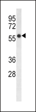 Delta-6 Desaturase / FADS2 Antibody - FADS2 Antibody western blot of HepG2 cell line lysates (35 ug/lane). The FADS2 antibody detected the FADS2 protein (arrow).