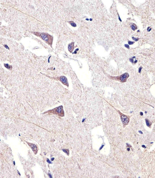 Delta-6 Desaturase / FADS2 Antibody - Immunohistochemical of paraffin-embedded H.brain section using FADS2 Antibody. Antibody was diluted at 1:25 dilution. A peroxidase-conjugated goat anti-rabbit IgG at 1:400 dilution was used as the secondary antibody, followed by DAB staining.
