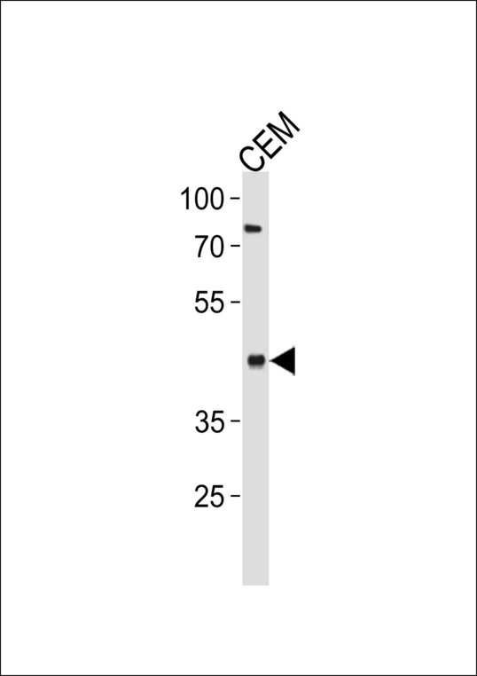 Delta-6 Desaturase / FADS2 Antibody - FADS2 Antibody western blot of CEM cell line lysates (35 ug/lane). The FADS2 antibody detected the FADS2 protein (arrow).