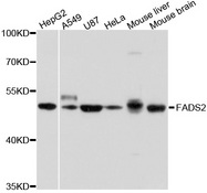 Delta-6 Desaturase / FADS2 Antibody - Western blot analysis of extracts of various cell lines, using FADS2 antibody at 1:1000 dilution. The secondary antibody used was an HRP Goat Anti-Rabbit IgG (H+L) at 1:10000 dilution. Lysates were loaded 25ug per lane and 3% nonfat dry milk in TBST was used for blocking. An ECL Kit was used for detection and the exposure time was 3s.