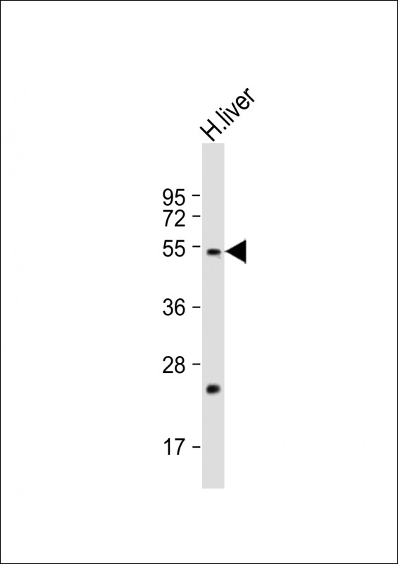 Delta-6 Desaturase / FADS2 Antibody - Anti-FADS2 Antibody at 1:2000 dilution + Human liver lysate Lysates/proteins at 20 µg per lane. Secondary Goat Anti-Rabbit IgG, (H+L), Peroxidase conjugated at 1/10000 dilution. Predicted band size: 52 kDa Blocking/Dilution buffer: 5% NFDM/TBST.