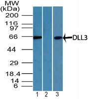Delta3 / DLL3 Antibody - Western blot of DLL3 in mouse embryo brain lysate in the 1) absence and 2) presence of immunizing peptide and 3) T98G cell lysate using Polyclonal Antibody to DLL3 at 3 and 5 ug/ml respectively. Goat anti-rabbit Ig HRP secondary antibody, and PicoTect ECL substrate solution, were used for this test.