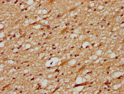 Delta3 / DLL3 Antibody - IHC image of DLL3 Antibody diluted at 1:700 and staining in paraffin-embedded human brain tissue performed on a Leica BondTM system. After dewaxing and hydration, antigen retrieval was mediated by high pressure in a citrate buffer (pH 6.0). Section was blocked with 10% normal goat serum 30min at RT. Then primary antibody (1% BSA) was incubated at 4°C overnight. The primary is detected by a biotinylated secondary antibody and visualized using an HRP conjugated SP system.
