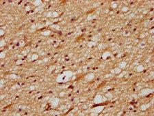 Delta3 / DLL3 Antibody - IHC image of DLL3 Antibody diluted at 1:700 and staining in paraffin-embedded human brain tissue performed on a Leica BondTM system. After dewaxing and hydration, antigen retrieval was mediated by high pressure in a citrate buffer (pH 6.0). Section was blocked with 10% normal goat serum 30min at RT. Then primary antibody (1% BSA) was incubated at 4°C overnight. The primary is detected by a biotinylated secondary antibody and visualized using an HRP conjugated SP system.