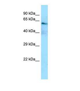 Delta3 / DLL3 Antibody - Western blot of Human HeLa. DLL3 antibody dilution 1.0 ug/ml.  This image was taken for the unconjugated form of this product. Other forms have not been tested.