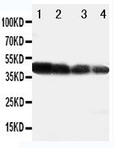 Delta3 / DLL3 Antibody - WB of Delta3 / DLL3 antibody. Recombinant Protein Detection Source:. E.coli derived -recombinant human DLL1, 39.9KD. (162aa tag+M1-G200). Lane 1: Recombinant Human DLL1 Protein 10ng. Lane 2: Recombinant Human DLL1 Protein 5ng. Lane 3: Recombinant Human DLL1 Protein 2.5ng. Lane 4: Recombinant Human DLL1 Protein 1.25n.