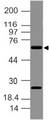 Delta3 / DLL3 Antibody - Fig-1: Expression analysis of Delta like 3. Anti-Delta like 3 antibody was used at 2 µg/ml on A375 lysate.