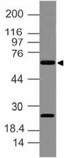 Delta3 / DLL3 Antibody - Fig-1: Expression analysis of Delta like 3. Anti-Delta like 3 antibody was used at 2 µg/ml on A375 lysate.