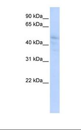 Delta3 / DLL3 Antibody - HepG2 cell lysate. Antibody concentration: 1.0 ug/ml. Gel concentration: 12%.  This image was taken for the unconjugated form of this product. Other forms have not been tested.