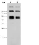Dengue NS1 Antibody - Anti-Dengue virus (DENV) (type 2, strain New Guinea C) NS1 rabbit polyclonal antibody at 1:2000 dilution. Sample: Dengue virus (DENV) (type 2, strain New Guinea C) NS1 Recombinant Protein. Lane A: 30ng. Lane B: 10ng. SecondaryGoat Anti-Rabbit IgG (H+L)/HRP at 1/10000 dilution. Developed using the ECL technique. Performed under reducing conditions.