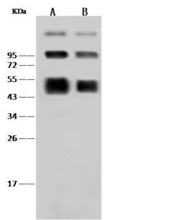 Dengue NS1 Antibody - Anti-Dengue virus (DENV) (type 2, strain New Guinea C) NS1 rabbit polyclonal antibody at 1:2000 dilution. Sample: Dengue virus (DENV) (type 2, strain New Guinea C) NS1 Recombinant Protein. Lane A: 30ng. Lane B: 10ng. SecondaryGoat Anti-Rabbit IgG (H+L)/HRP at 1/10000 dilution. Developed using the ECL technique. Performed under reducing conditions.