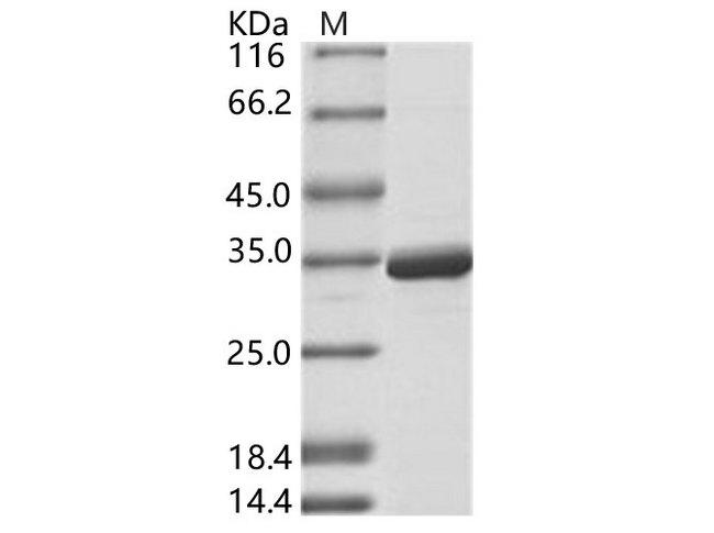 Dengue Virus NS5 Protein - Recombinant DENV-2 (strain New Guinea C) NS5 (methyltransferase domain) / Nonstructural protein 5 Protein (His Tag)