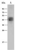 Dengue Virus Type 2 Envelope Antibody - Anti-Dengue virus (DENV) (type 2, strain New Guinea C/PUO-218 hybrid) E / Envelope Protein (ECD) rabbit polyclonal antibody at 1:2000 dilution. Sample: Dengue virus (DENV) (type 2, strain New Guinea C/PUO-218 hybrid) E / Envelope Protein (ECD, His Tag). Lane A: 5ng. Secondary: Goat Anti-Rabbit IgG (H+L)/HRP at 1/10000 dilution. Developed using the ECL technique. Performed under reducing conditions.