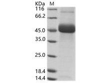 Dengue Virus Type 2 Protein - Recombinant DENV (type 2, strain New Guinea C) NS1 Protein (His Tag)