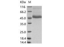 Dengue Virus Type 3 Protein - Recombinant DENV (type 3, strain Philippines/H87/1956) NS1 Protein (His Tag)