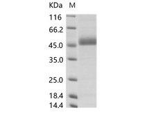 Dengue Virus Type 4 Protein - Recombinant DENV (type 4, strain Philippines/H241/1956) NS1 Protein (His Tag)